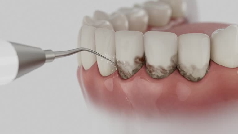 Reliable Dental contractor in Lake Summerset, IL by Dentist Open Now